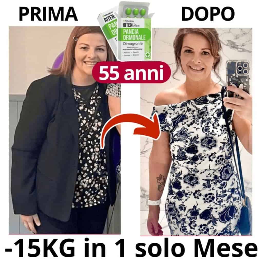Donna prima e dopo perdita di peso di 15kg con RitenDren.