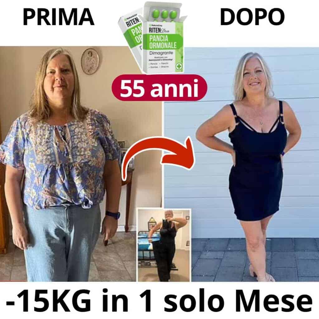 Donna prima e dopo perdita di peso con RitenDren 1x24 Stress Ormonale.